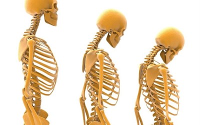Světový den osteoporózy – 20. října